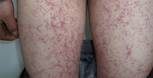 ������������κ��� ��񰻼���ճ�����